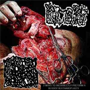Amorphous Ptoma On Decay / Urachus - 2 Ways To Incorrectly Perform a Bloody Blepharoplasty FLAC album