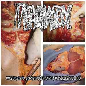 Traumatic Brain Injury - Human Anatomy Dissection FLAC album