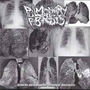 Pulmonary Fibrosis / Agathocles - Broncho-pneumopathie Chronique Obstructive / Suppository Of Speed FLAC album