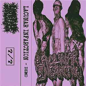 Lacunar Infarction - Demo FLAC album