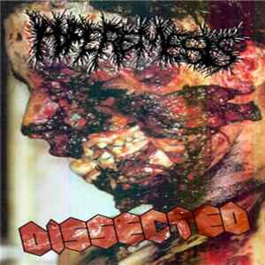 Hyperemesis / Dissected - Hyperemesis / Dissected FLAC album