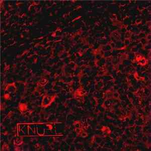 Knurl - Hyperplasia FLAC album