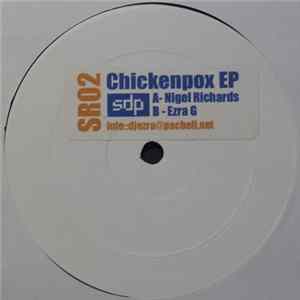 Nigel Richards vs Ezra G - Chickenpox EP FLAC album